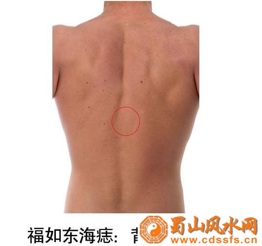 五处胎记影响你的运势